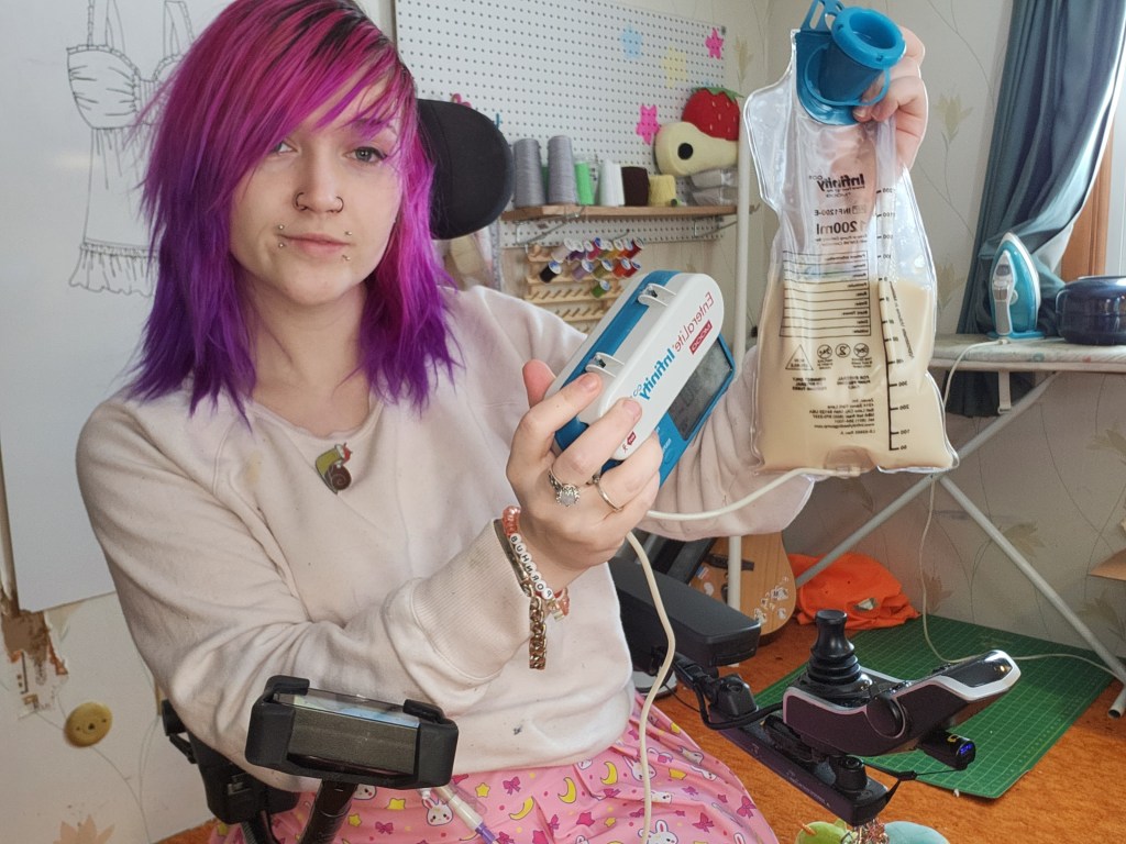 Chrysanthemum uses a feeding tube to get the calories and nutrition she needs.